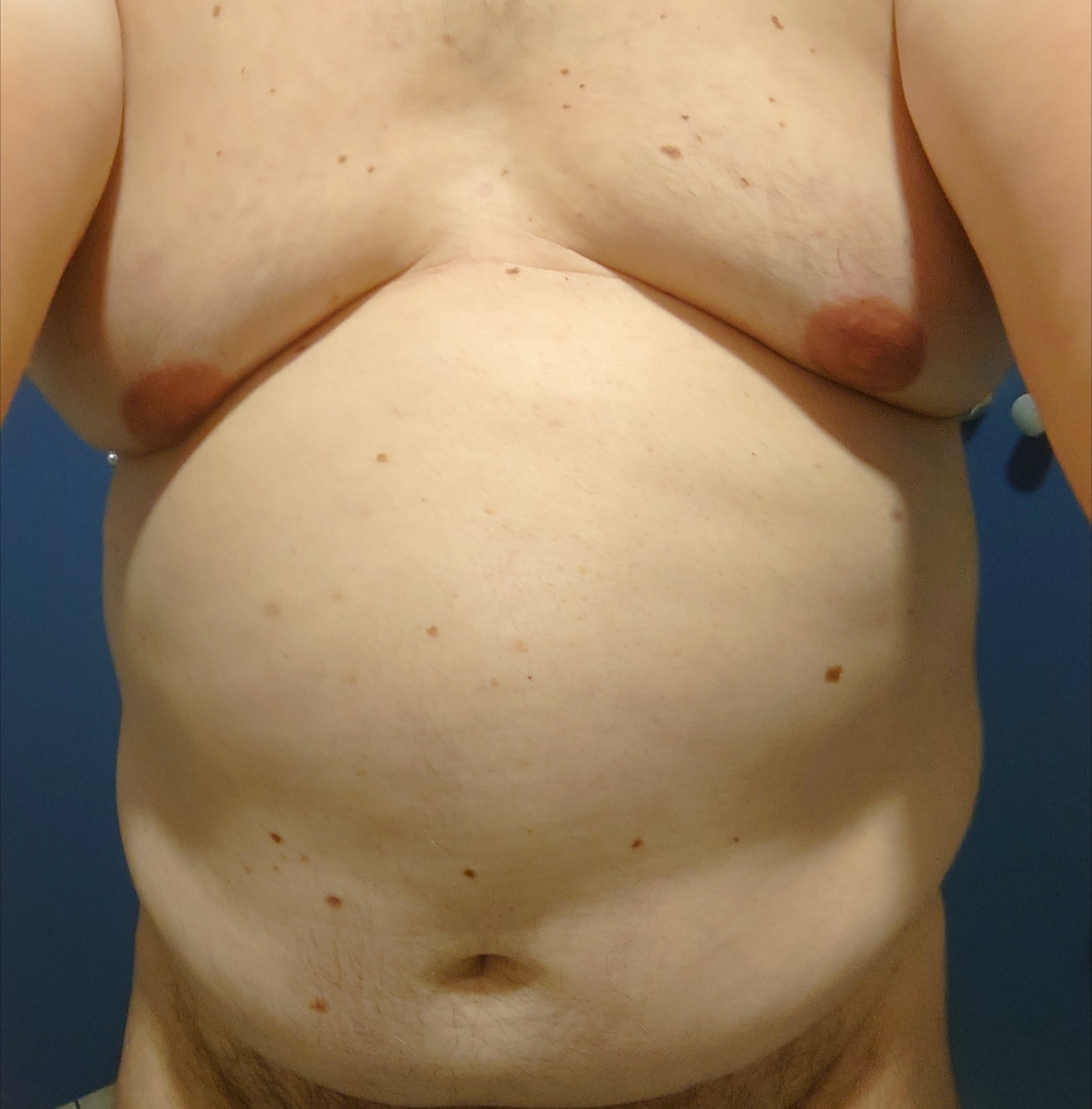 Rosin - Aedermannsdorf - Soleure | Gay